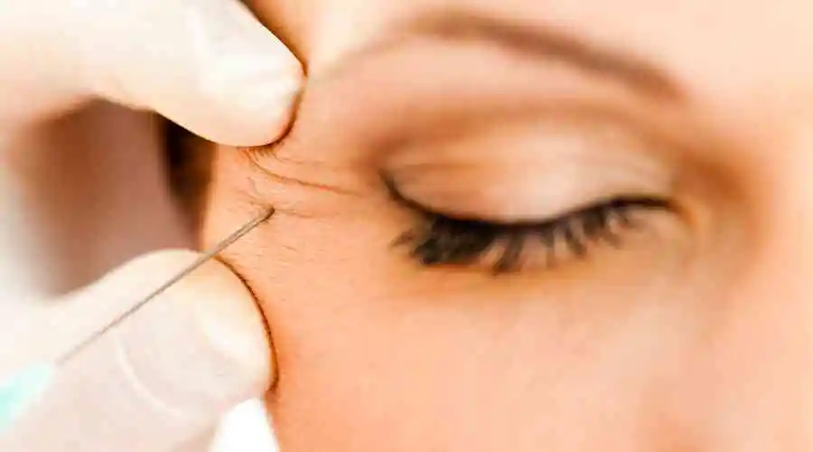 Botox for Under Eye Wrinkles: Yea or Nay